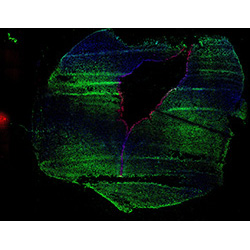 11PCW human midbrain